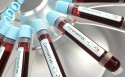 PCR: O Exame que detecta o covid-19
