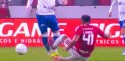 Em estreia, jogador sofre fratura em entrada criminosa no Brasileirão (veja o vídeo)