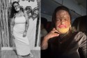 Influenciadora morre aos 31 anos após longa batalha contra doença rara