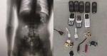 “Caneco Forte”: Detento tenta entrar em presídio com “8” celulares dentro do corpo (veja as fotos)
