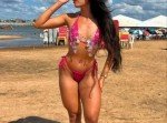 Mais uma morte de influenciadora após cirurgia plástica