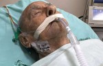 "Vovô Anésio" é internado na UTI após sofrer parada cardiorrespiratória
