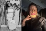 Influenciadora morre aos 31 anos após longa batalha contra doença rara