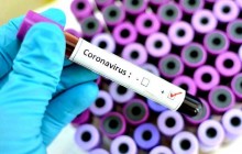 O Coronavírus e os canalhas que tiram proveito do caos