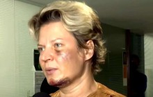 Depois de anos, Joice vem à público e acusa família Bolsonaro por ficar 'deformada' após suposta agressão