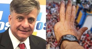 Deputado apresenta projeto para amputação das mãos de corruptos (veja o PL)