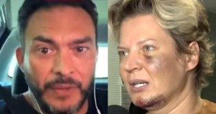 Senador causa polêmica monstruosa e diz que hematomas de Joice podem ser resultado "de chifre ou de pó" (veja o vídeo)
