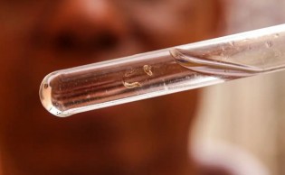 Brasil poderá ultrapassar 3,5 milhões de casos de dengue no ano e número de mortes dispara