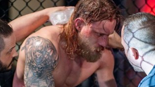 Ex-lutador de UFC é esfaqueado e ‘perto da morte’ reage e noucateia agressor