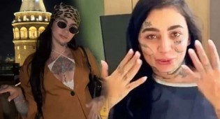 Cantora brasileira morre após complicações com cirurgia estética
