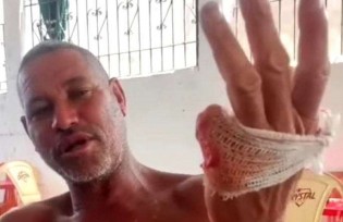 Cidadão baiano viraliza após amputar um dedo para cumprir promessa por vitória de Lula (veja o vídeo)