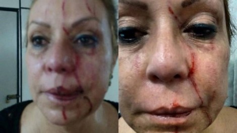 Médica é agredida em sala de atendimento de posto de saúde