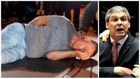 Seguranças de Lindbergh cometeram tentativa de homicídio com o possível consentimento do senador (Veja o Vídeo)