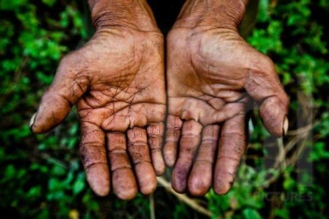 Ponham a mão na consciência: Impedir uma pessoa humilde de buscar o pão para sua casa é uma crueldade