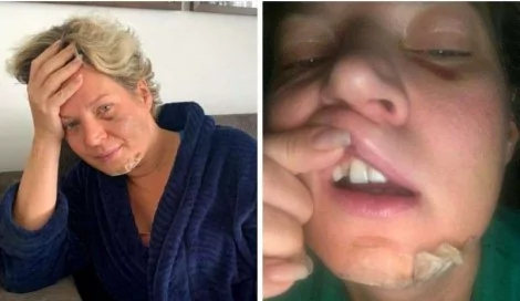 Foto reprodução