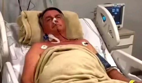 Médicos falam pela 1ª vez sobre cirurgia de Bolsonaro e avisam: “Sem previsão de sair da UTI”
