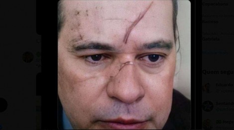 Queda de Toffoli favorece interesses inconfessáveis de Lula