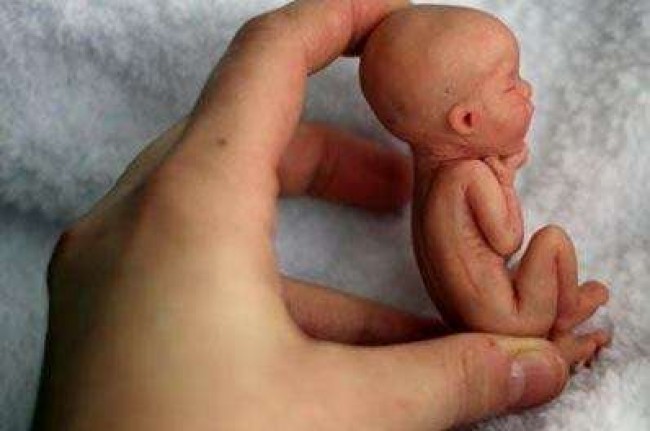 Na foto, um bebê de 12 semanas, que agora pode ser morto legalmente na Argentina.